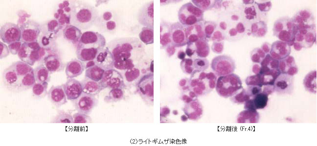 ライトギムザ染色像