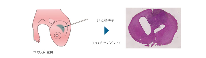 マウス脳への直接がん遺伝子導入による脳腫瘍モデルの構築